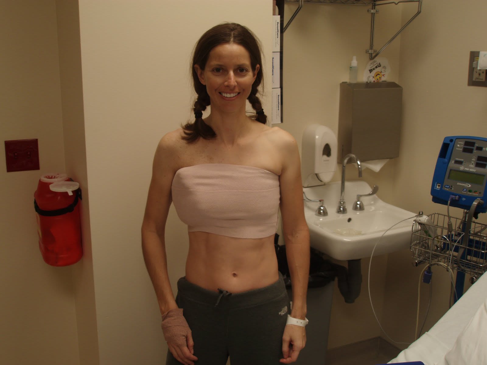 удаление и восстановление груди в одну операцию фото 103